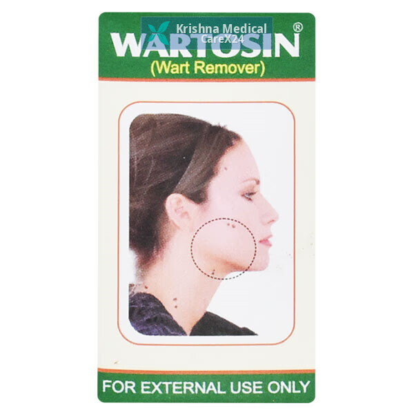 Wartosin Wart Remover